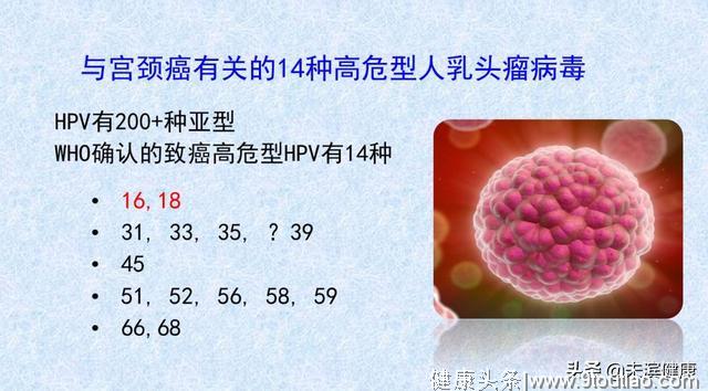 宫颈癌筛查的奇葩解释