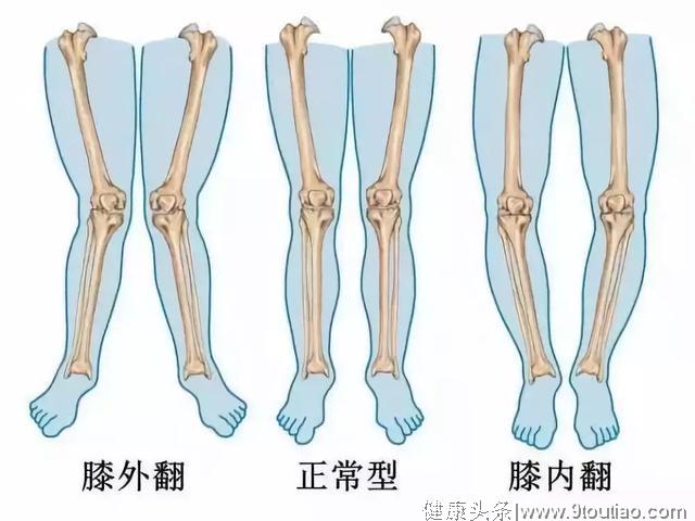 膝盖痛自疗法：滑膜炎、骨关节炎、半月板损伤都有效