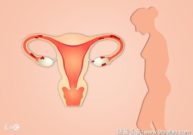 子宫内膜增厚到底是什么原因