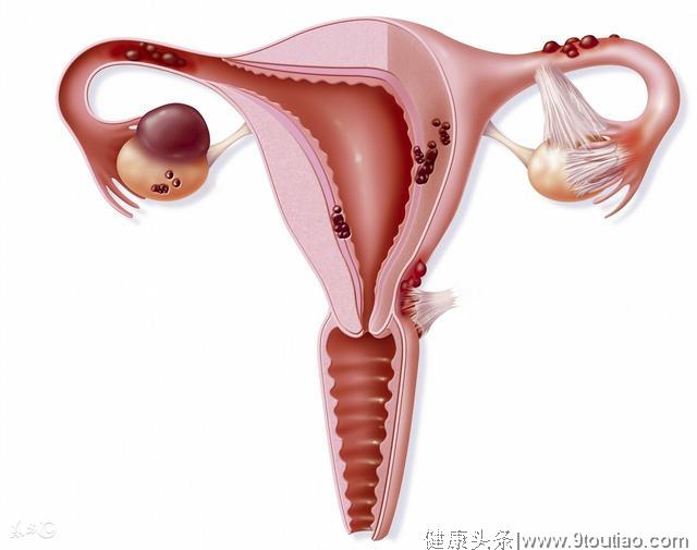 子宫内膜增厚到底是什么原因