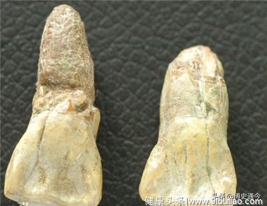 中国发现两颗古人类牙齿，公布时间非常蹊跷，在尼克松访华那天