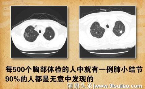肺结节不可小视，若出现这3种情况，很容易变肺癌