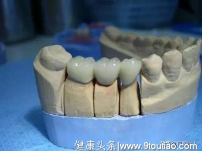 这样的种植牙治疗你敢做吗？