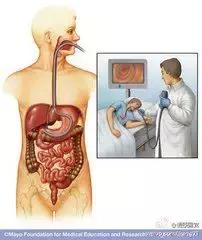 注意：胃部检查出现3种情况，说明胃癌已经来袭，别错失治疗良机