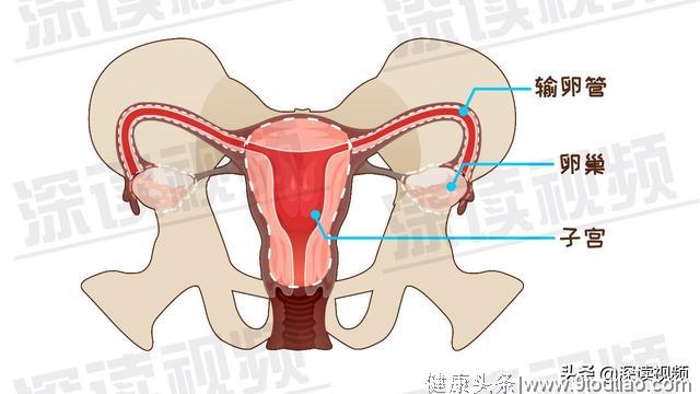 受精卵缘何子宫外安家