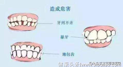 口腔内科第一问：乳牙蛀了要不要治疗？