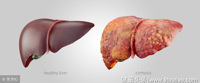 肝癌“祸根”终于发现了，医生：肝脏最怕这4样，改掉一个能加寿