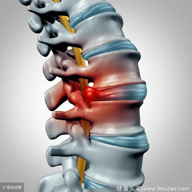 腰痛知多少？一问一答，让你轻松了解腰椎间盘突出症的若干问题