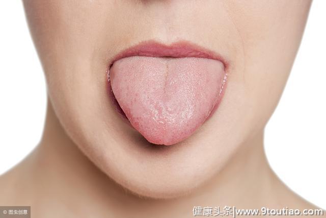教你中医如何望舌诊病，舌头有这四种症状，说明你生病了