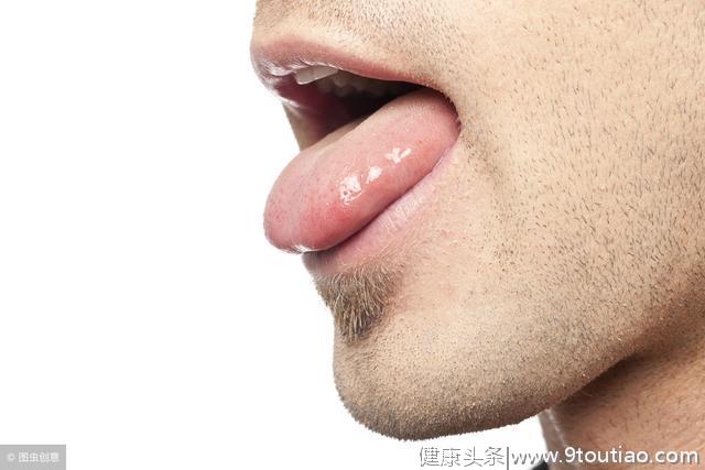 教你中医如何望舌诊病，舌头有这四种症状，说明你生病了