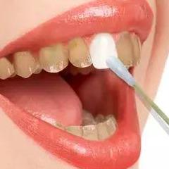 想要发黄的牙齿变洁白，刷牙是刷不出来的，还得配合一款牙膏伴侣