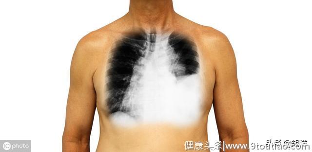 什么样的症状提示肺癌，医生列出7点，每一点都可能是肺癌征兆