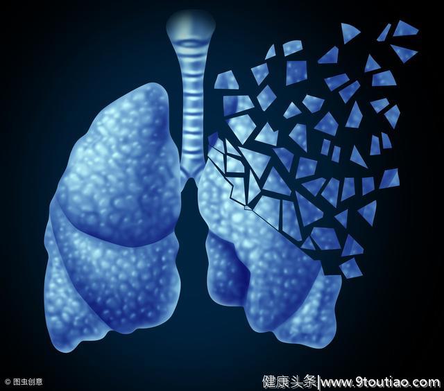 早期肺癌会发出什么信号，介绍几个肺癌早期的蛛丝马迹