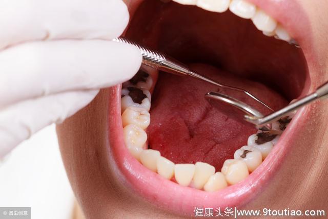 胃火旺易口臭？口腔专家讲：嘴里异味严重，是你的牙“生病了”！