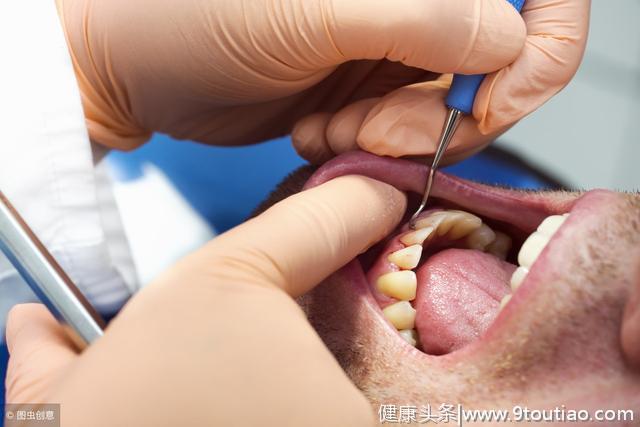 胃火旺易口臭？口腔专家讲：嘴里异味严重，是你的牙“生病了”！