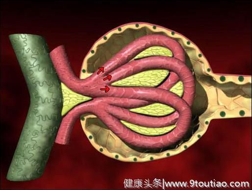 每1.5秒就有一个人发生尿毒症，糖尿病或成为尿毒症最大的后备军