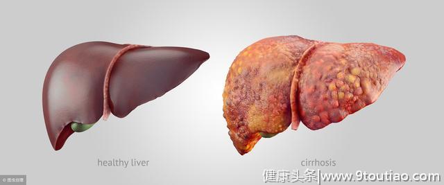 为何中国"肝癌"发病率能占到全球一半？专家直言：这2件事要少做