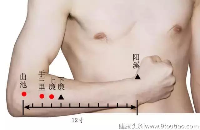 22种痛症的针灸穴位