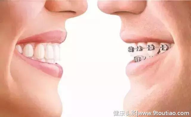 Helen齿科中心——牙齿不齐•影响健康