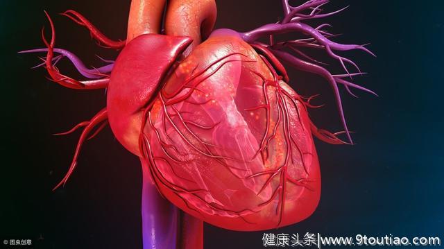心脏血管狭窄1-100%，到底多少才是冠心病？到底多少才会放支架？