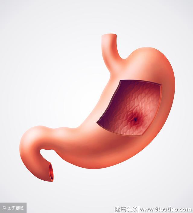 慢性胃炎大致分为3类、哪种危害更大？哪种会导致胃癌呢？