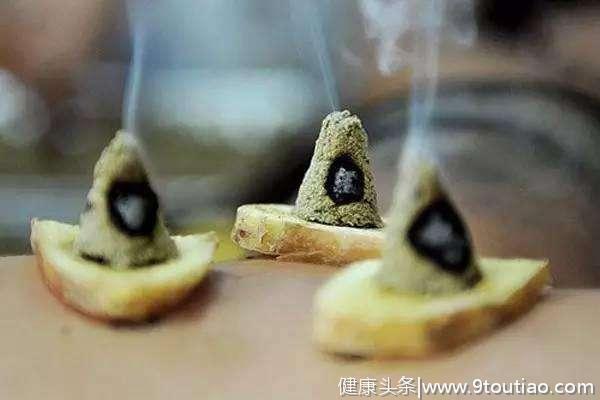 艾灸治病的原理   艾灸在治疗疾病过程中的运用