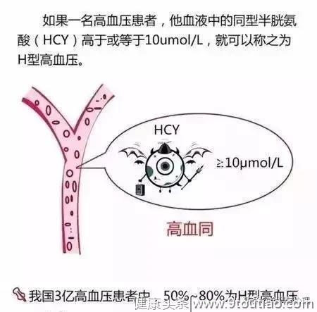 有高血压家族史，更要注意H型高血压