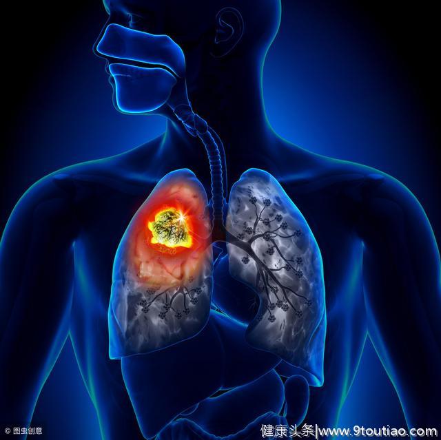 不给疾病留可乘之机，六个身体微妙变化提醒你肺癌来了