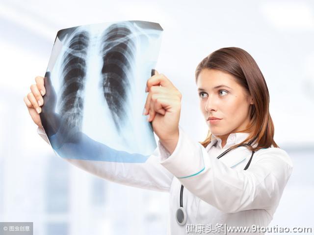 肺癌确诊为什么多为晚期？10大早期征象值得警惕！