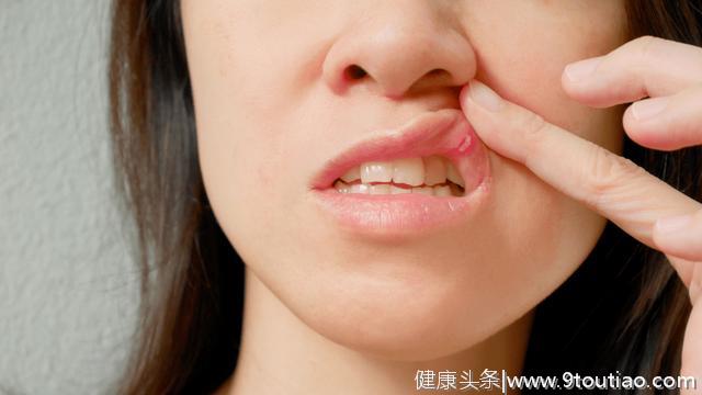 舌红、口臭、口腔溃疡，嘴里出现这些信号，小心缺乏这种维生素