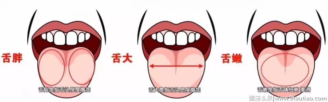 嘴巴出现6种迹象，说明你脾胃亮"红灯"啦！（实用自查）