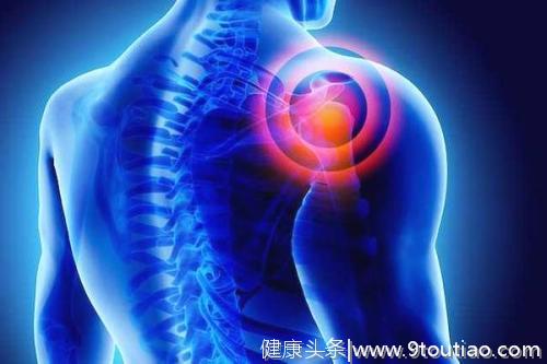 骨科：肩膀痛就是肩周炎吗？如何判断自己的肩痛是不是肩周炎？