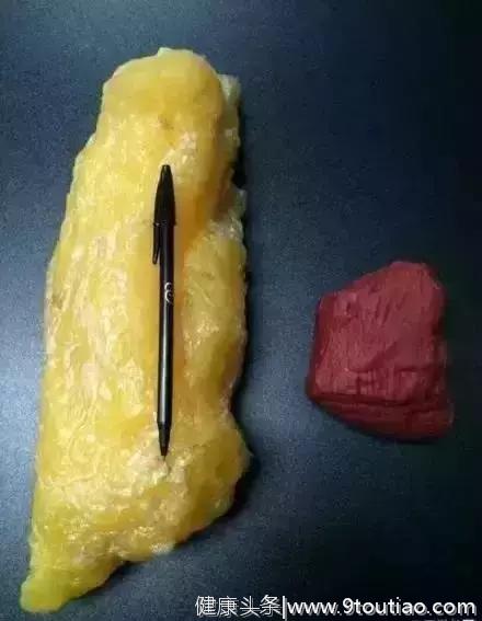 相同体重，肥胖身材VS肌肉身材对比图，差别真大！
