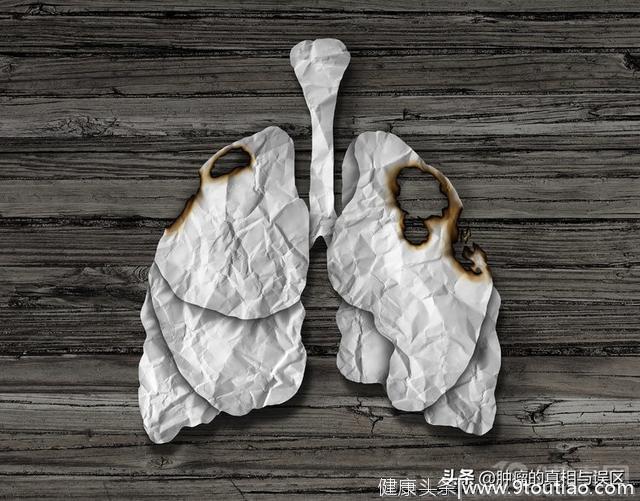 肺癌诱因有4个，虽然不吸烟，但也不代表你很安全
