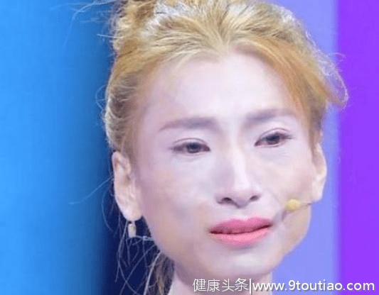 某节目女嘉宾为爱减肥70斤，瘦成骨架吓到观众