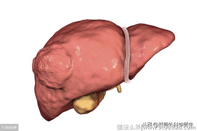 肝癌，不一定代表着死亡