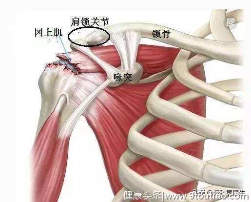 骨科医生：肩周炎就是这2块肌肉，1根神经有了问题导致的