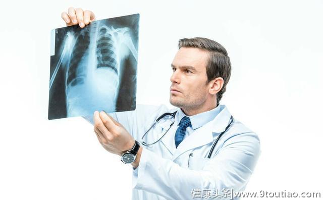 肺癌晚期60%的患者发生胸腔积液，其主要原因是胸膜转移！