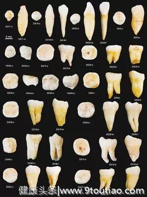 为什么有的人是28颗牙齿，有人是32颗？有人是尖牙，有人长兔牙？