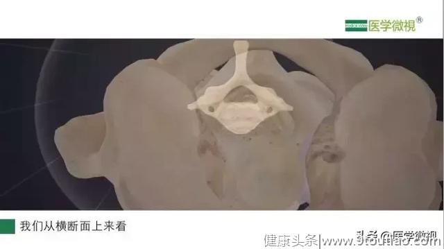 神经根型颈椎病会导致胳膊甚至手指疼痛、麻木吗？