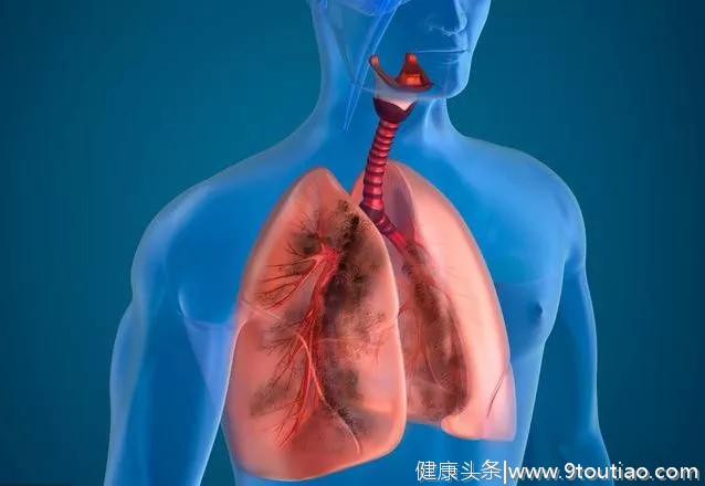肺癌晚期发生咳嗽、气短、疼痛等等症状该怎么办呢？