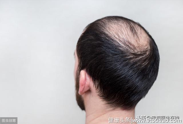 “脱发”成为年轻人的标志？4件事，护住头发
