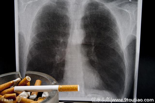 肺部有阴影就一定是肺癌吗?三类人要特别当心肺部阴影
