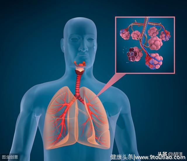 小细胞肺癌对化疗敏感，能把肿瘤化没了，但这一缺点让疗效难长久