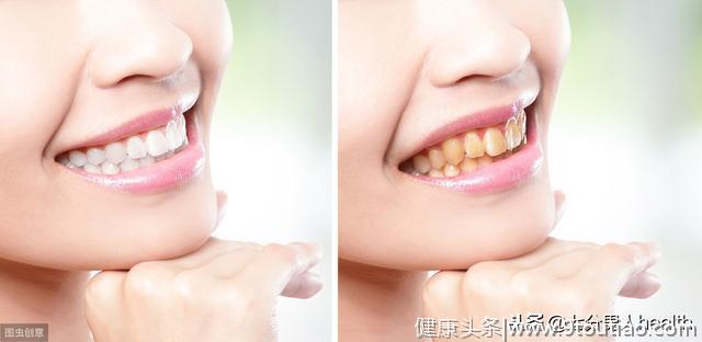 美国牙医耗时10年，发现最伤牙的是它们，比不刷牙还恐怖