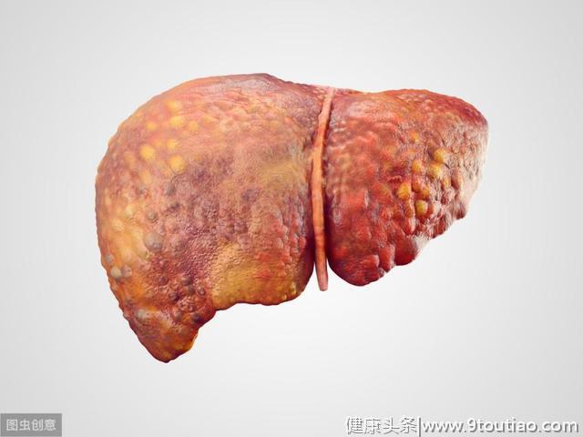 肝癌"元凶"找到了，不只是烟酒，面部若出现4种异常，早做CT