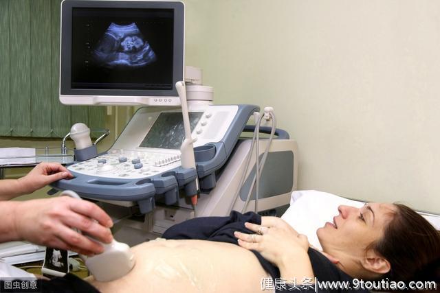 当你怀孕4周时身体会发生什么变化？需要服用产前维生素吗？