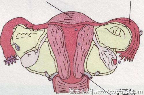 15岁女孩患宫颈癌，医生感叹：都是自己“作”的，很多女孩不在意