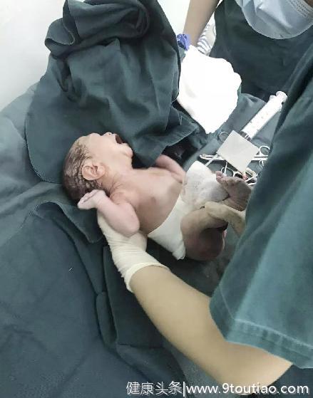 扬州一高龄产妇怀孕37周从未做产检，胎儿宫内缺氧，医生2小时手术救了一男婴