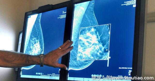 5个微妙的迹象出现，女人请小心乳腺癌